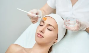 Close-up of smooth, glowing facial skin demonstrating the benefits of a summer chemical peel in in Hammond, LA